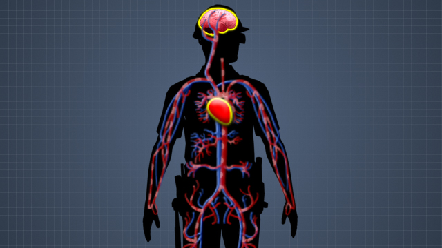 First Aid Dehydration Video Convergence Training